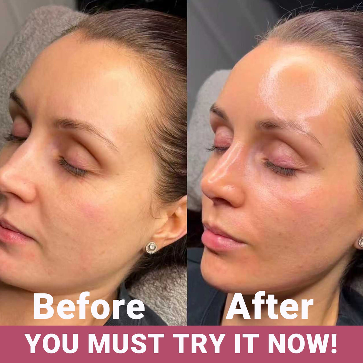 Bio-Collagen Face Mask Glow Up