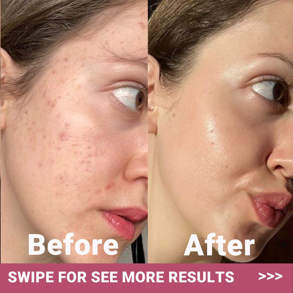 Bio-Collagen Face Mask Glow Up
