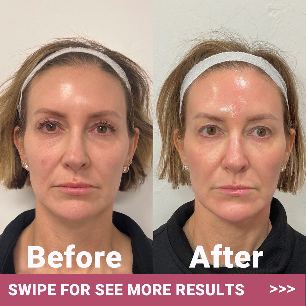 Bio-Collagen Face Mask Glow Up