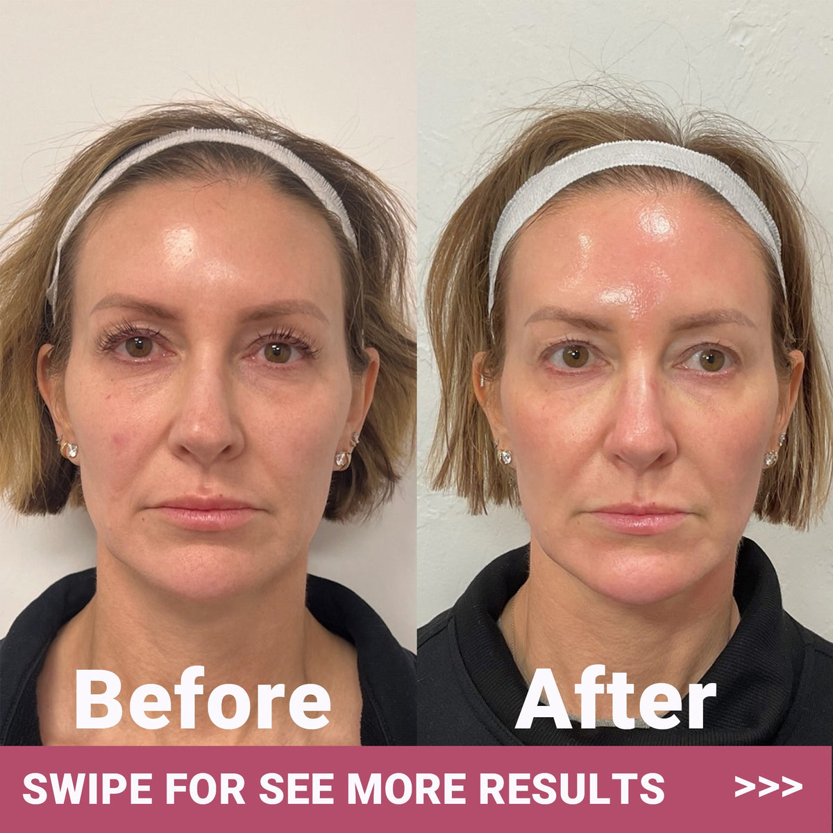 Bio-Collagen Face Mask Glow Up