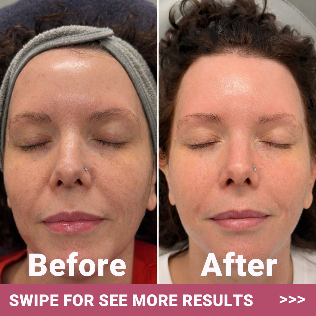Bio-Collagen Face Mask Glow Up